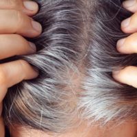 Вызывает ли стресс седые волосы?